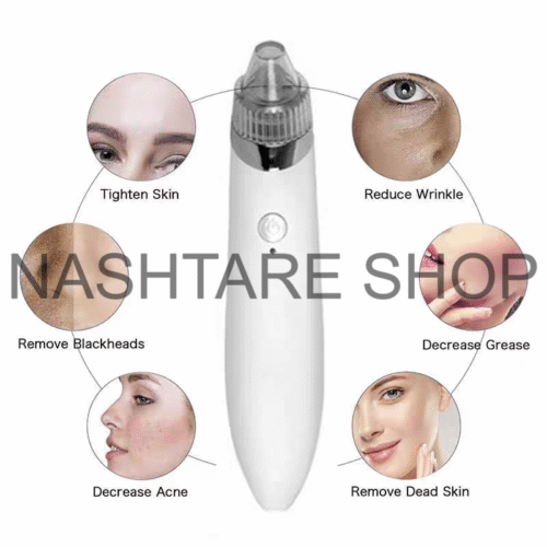 Electric Blackhead Remover | جهاز شفط و إزالة الرؤوس السوداء