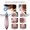 Electric Blackhead Remover | جهاز شفط و إزالة الرؤوس السوداء